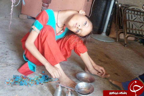 تعصب خرافی روستاییان، کودک ۹ ساله را از جامعه طرد کرده است +تصاویر