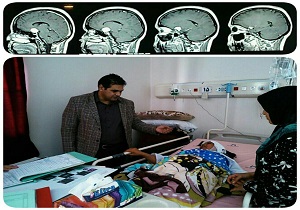خارج کردن تومور مغزی از سر بیمار 35 ساله