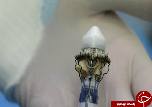 جراحی قلب با استفاده از دریچه&zwnj;های بدون نیاز به بخیه + تصاویر