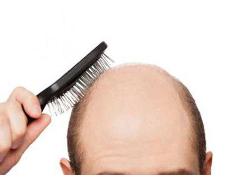 غیرمجاز بودن معرفی کلینیک&zwnj;های کاشت مو در شبکه&zwnj;های ماهواره&zwnj;ای
