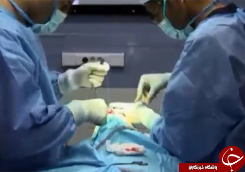 مضرات عمل جراحی زیبایی غیر ضروری بینی/سونامی افزایش آمار جراحی در ایران ولرستان+تصاویر