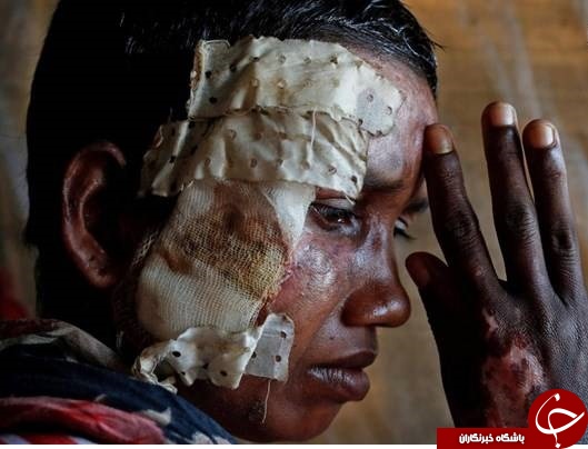 تصاویر دلخراش از شکنجه مسلمانان روهینگیا 13+