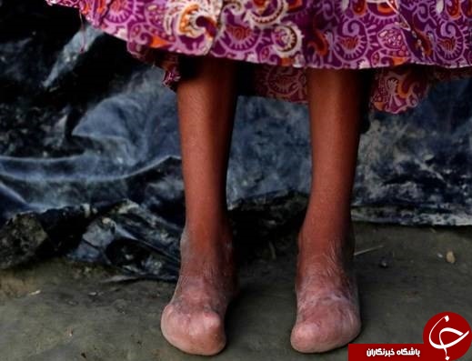 تصاویر دلخراش از شکنجه مسلمانان روهینگیا 13+