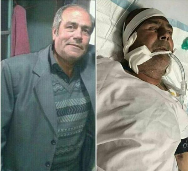 بازیگر &laquo;قلاده&zwnj;های طلا&raquo; تحت عمل جراحی قرار گرفت