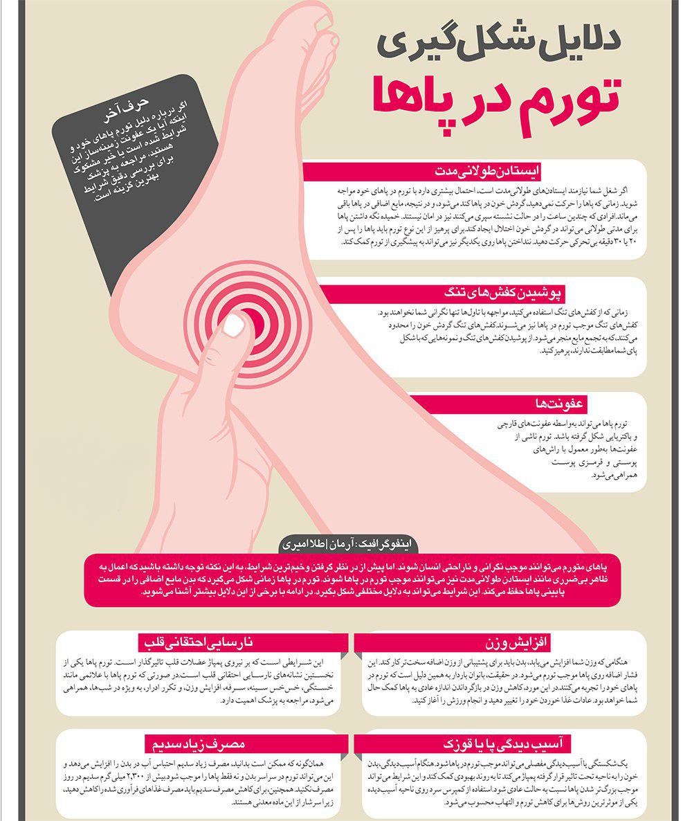 چرا پاها ورم می&zwnj;کنند؟