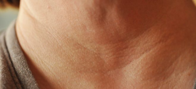 علت سیاه شدن پوست گردن چیست؟