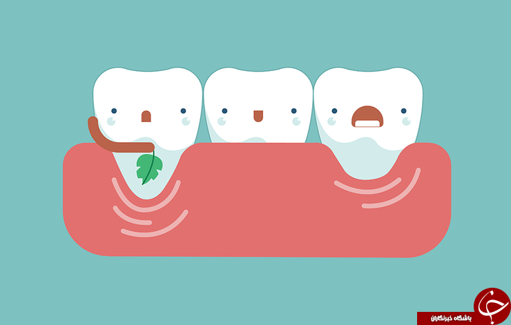 علائم مخفی پوکی استخوان چیست؟