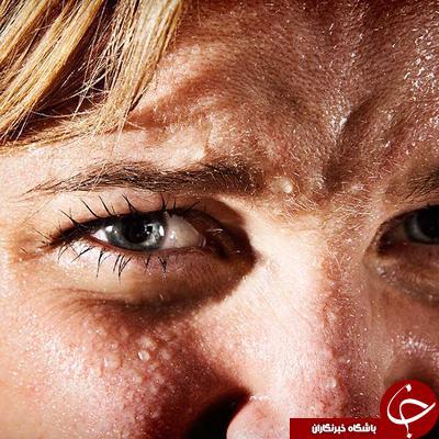علائم تیروئید که احتمالا از آن بی خبرید!