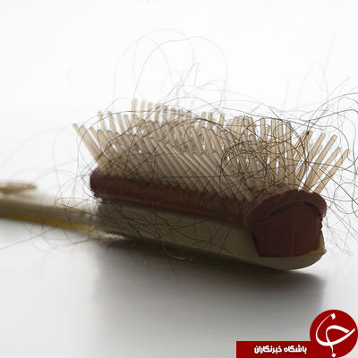 علائم تیروئید که احتمالا از آن بی خبرید!
