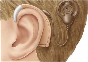 فراهم شدن شرایط اولیه برای عمل کاشت حلزون گوش در قزوین