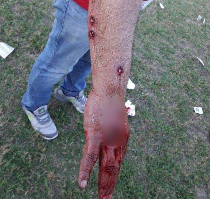 پلیس، فوتبالیست های آرژانتینی را وحشیانه به گلوله بست