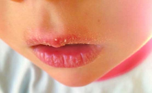 ارتباط مستقیم گوشت با ناراحتی های روانی/ دیابت را با اسفناج معالجه کنید/ خشکی لب ها مهمان ناخوانده فصول سرد/ روش هایی برای افزایش شیر مادر