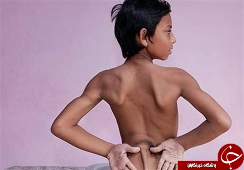 شیوع پدیده شیوع پدیده