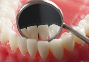 ٣ دقیقه آموزش در مطب&zwnj;های دندانپزشکى براى ارتقا سلامت دهان و دندان/در حوزه بهداشت دهان و دندان موفق نبودیم