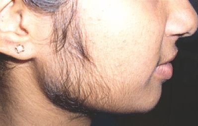 1-دگرگونی&zwnj;هایی درچهره که نشان دهنده ابتلای افراد به بیماری&zwnj;های خطرناک هستند2-این دگرگونی&zwnj;ها درچهره خود را جدی بگیرید3-بیماری&zwnj;هایی که بااین علامت&zwnj;ها درچهره خود را به شما نشان می&zwnj;دهند