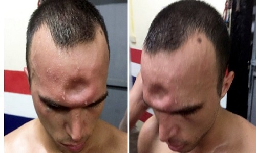 ضربه ای وحشتناک در یک مسابقه رزمی جمجمه ورزشکار را شکست+تصاویر ضربه ای وحشتناک در یک مسابقه رزمی جمجمه ورزشکار را شکست+تصاویر