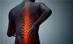 روش&zwnj;های جلوگیری از قوز کردن کمر
