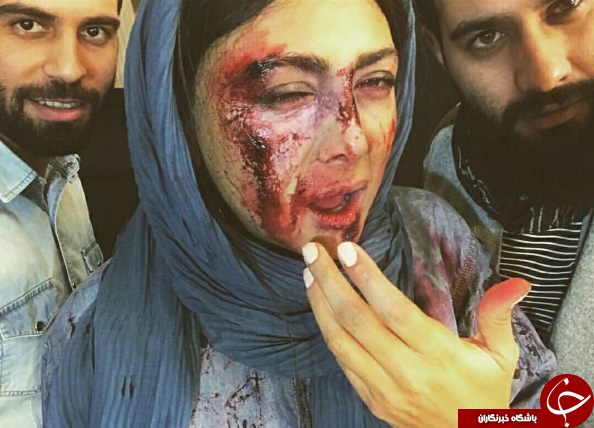 چهره کتک خورده بازیگر زن مشهور+عکس