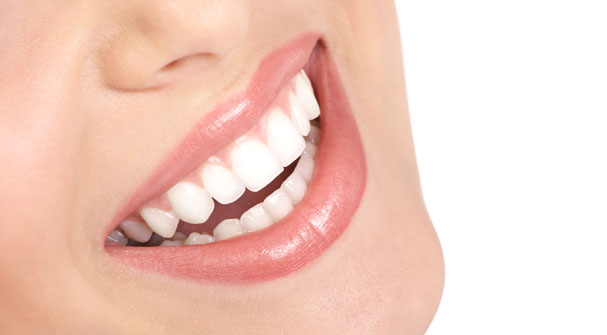 همه چیز درباره لمینت (ونیر) دندان