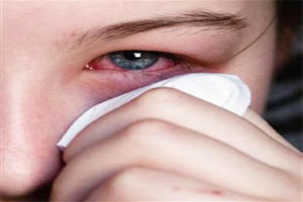 ضرورت پرهیز از لنز&zwnj;های اجاره&zwnj;ای/ مشکلات چشمی دیابتی ها، بزرگترین مشکل حوزه چشم&zwnj;پزشکی