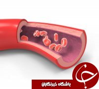 چگونه عروق و رگ&zwnj;هایتان را پاکسازی کنید؟