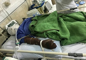 انفجار کپسول گاز در بیدستان