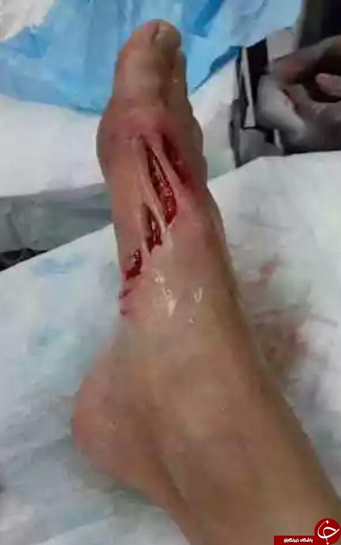 حمله مرگبار کوسه به پسر نوجوان + تصاویر/////////////////////