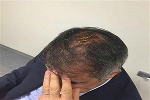 لحضه شکسته شدن سر سنول گونش در دربی استانبول + فیلم