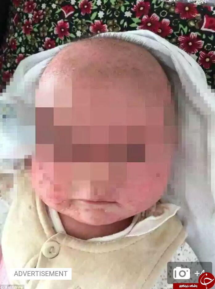 بی احتیاطی مادر، نوزادش را تا دم مرگ برد + تصاویر