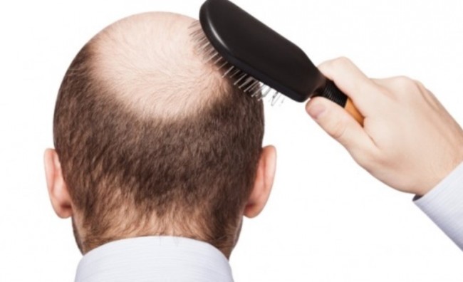 ۷ دلیل عجیب ریزش مو که اصلا تصورش را نمی&zwnj;کنید