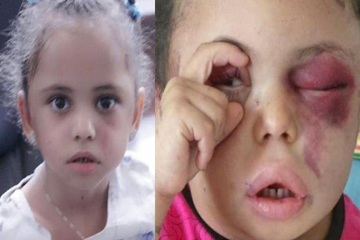 آزادی &laquo;چشم بشریت&raquo; پس از یک سال اسارت در عربستان