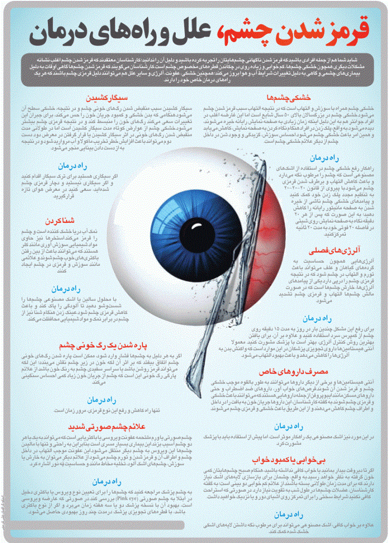 قرمزی چشم نشانه چیست؟ +اینفوگرافی