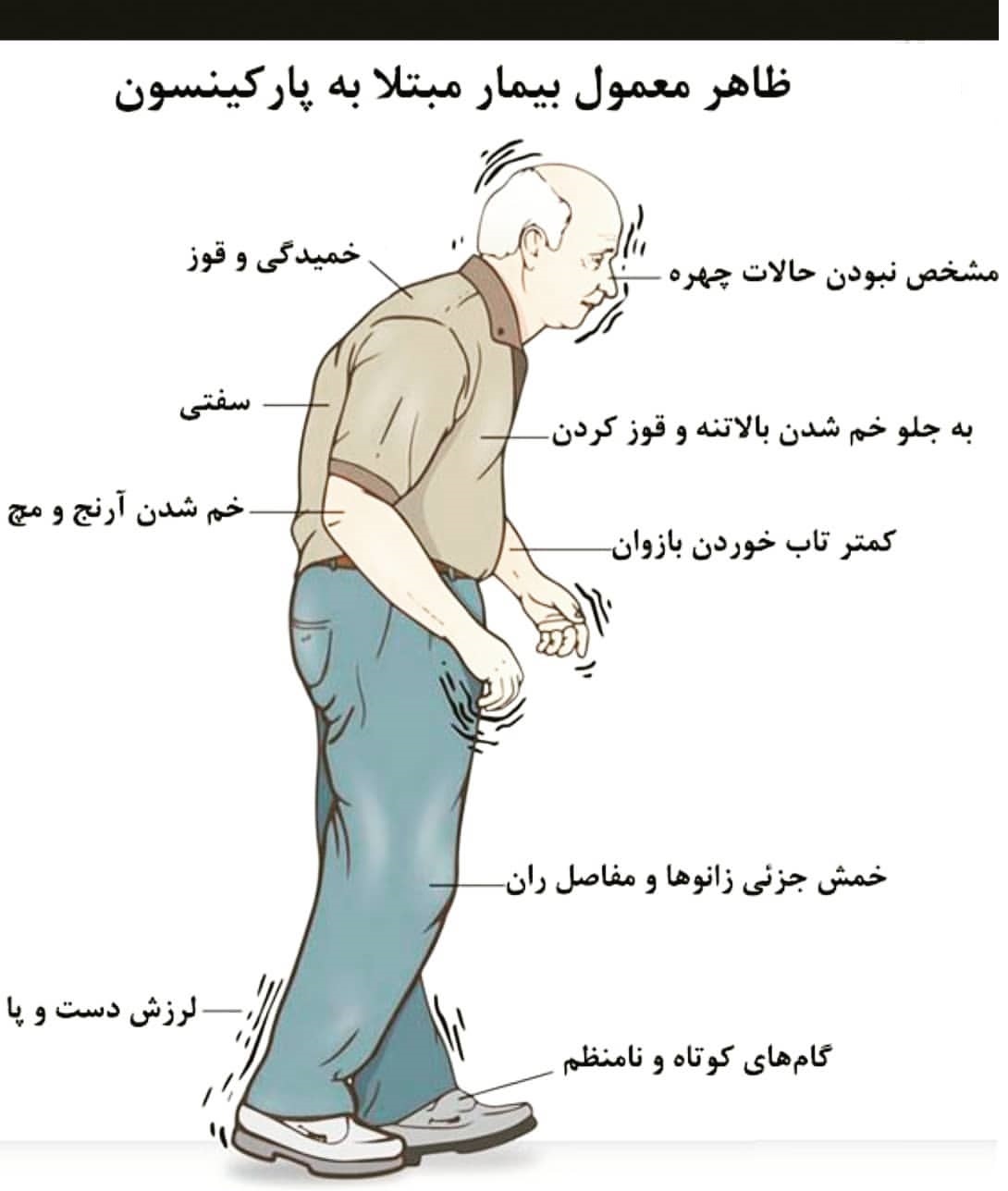 چه کسانی در معرض &laquo;پارکینسون&raquo; هستند؟ +اینفوگرافی