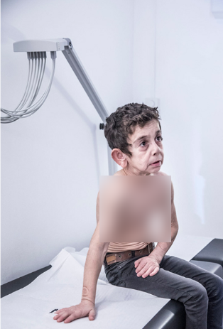 بیماری عجیب کودک سوری در لنز دوربین عکاس آلمانی جهان را تحت تاثیر قرار داد +عکس