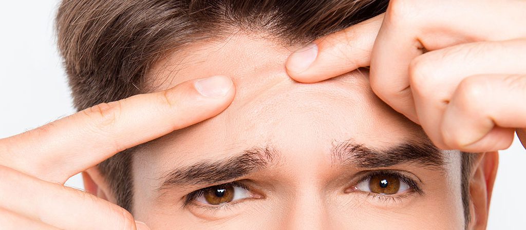 روشی جدید برای خلاصی از چاله چوله&zwnj;های صورت/ با اقدام به موقع از باقی ماندن جای جوش پیشگیری کنید