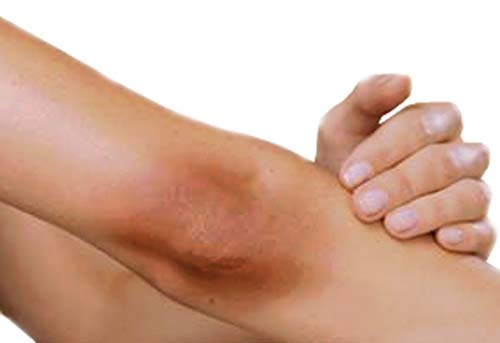 با ۱۰ روش طبیعی و مؤثر برای رفع تیرگی زانو و آرنج آشنا شوید