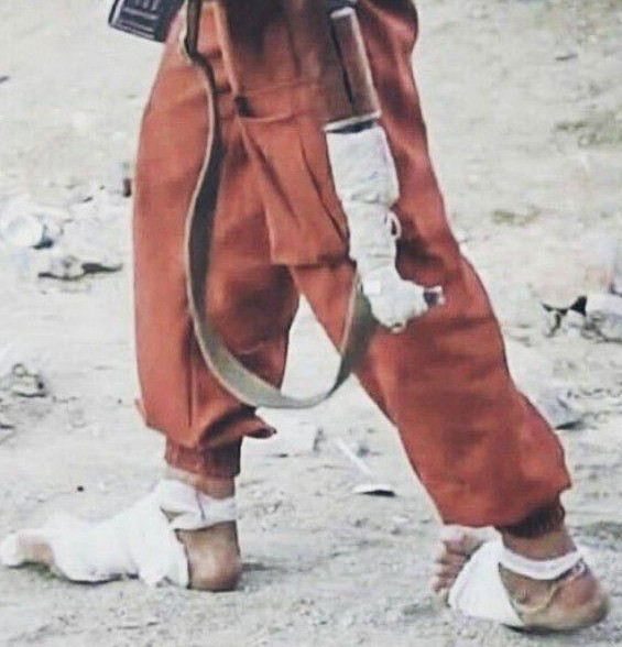 آبروی ائتلاف سعودی زیر پای برهنه سربازان یمنی +تصاویر