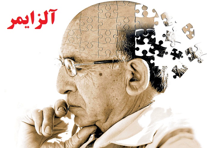 نشانه&zwnj;های هشدار دهنده بیماری آلزایمر را بشناسیم!