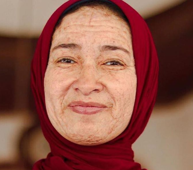 پیرزنی که فقط ۲۲ سال دارد! + تصاویر