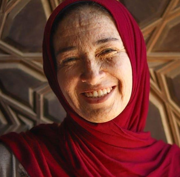 پیرزنی که فقط ۲۲ سال دارد! + تصاویر