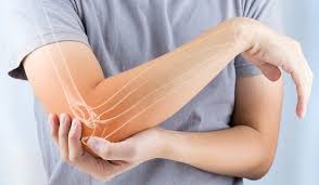 همه چیز درباره بیماری&zwnj;های مفصلی/ چگونه از ایجاد آرتریت جلوگیری کنیم؟