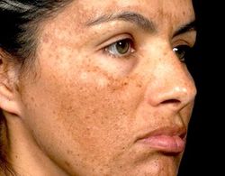 دو ویژگی مهم پوست بدن + فیلم