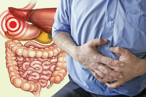 همه آنچه درباره زخم معده و دوازدهه باید بدانید+ رژیم غذایی و درمان