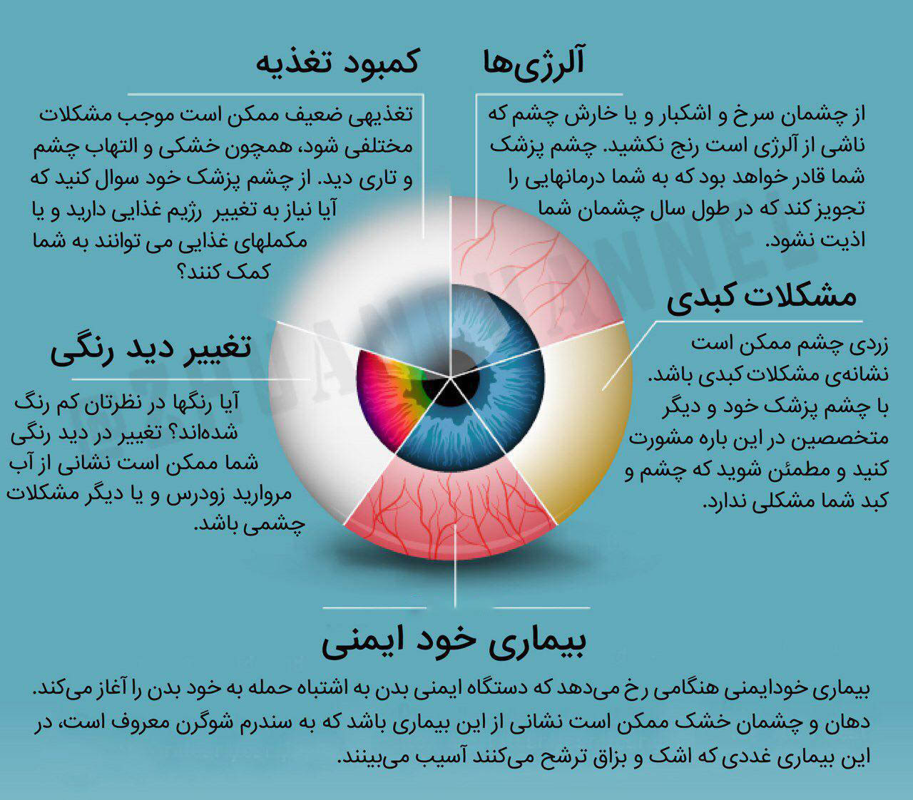 تغییر رنگ چشم نشان دهنده کمبود چه مواد غذایی است+ اینفوگرافی/// جمعه