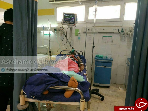 اولین تصویر یکی از مصدومین حادثه تروریستی نیکشهر+عکس
