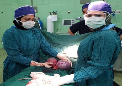 سومین عمل موفق آمیز خروج توده بزرگ شکمی در سردشت