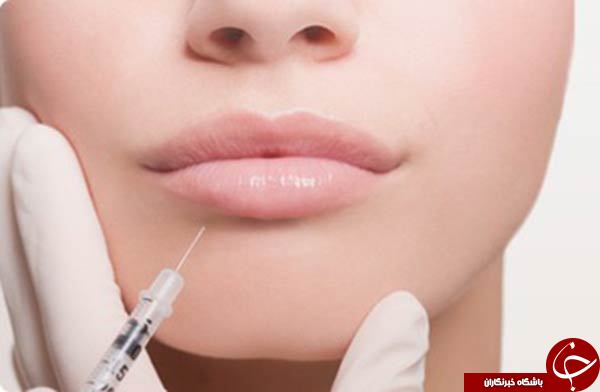 تزریق ژل چه تفاوتی با تزریق چربی دارد؟ / آیا جای تزریق ژل بر روی بدن باقی می&zwnj;ماند؟
