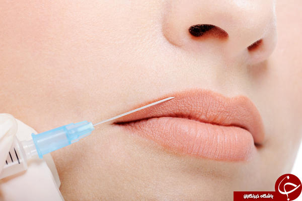 تزریق ژل چه تفاوتی با تزریق چربی دارد؟ / آیا جای تزریق ژل بر روی بدن باقی می&zwnj;ماند؟