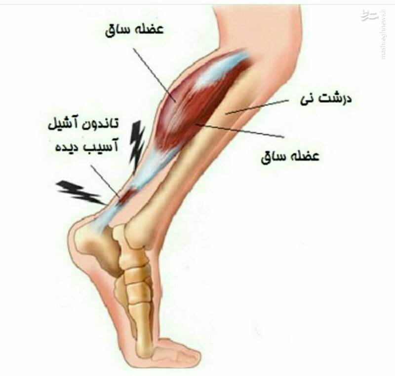 ماجرای پاشنه آشیل  آقاخان و شاهکار چندصد میلیونی مدیران استقلال بدون یک دقیقه بازی!