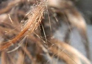 جنیدی/ عوارض موخوره
